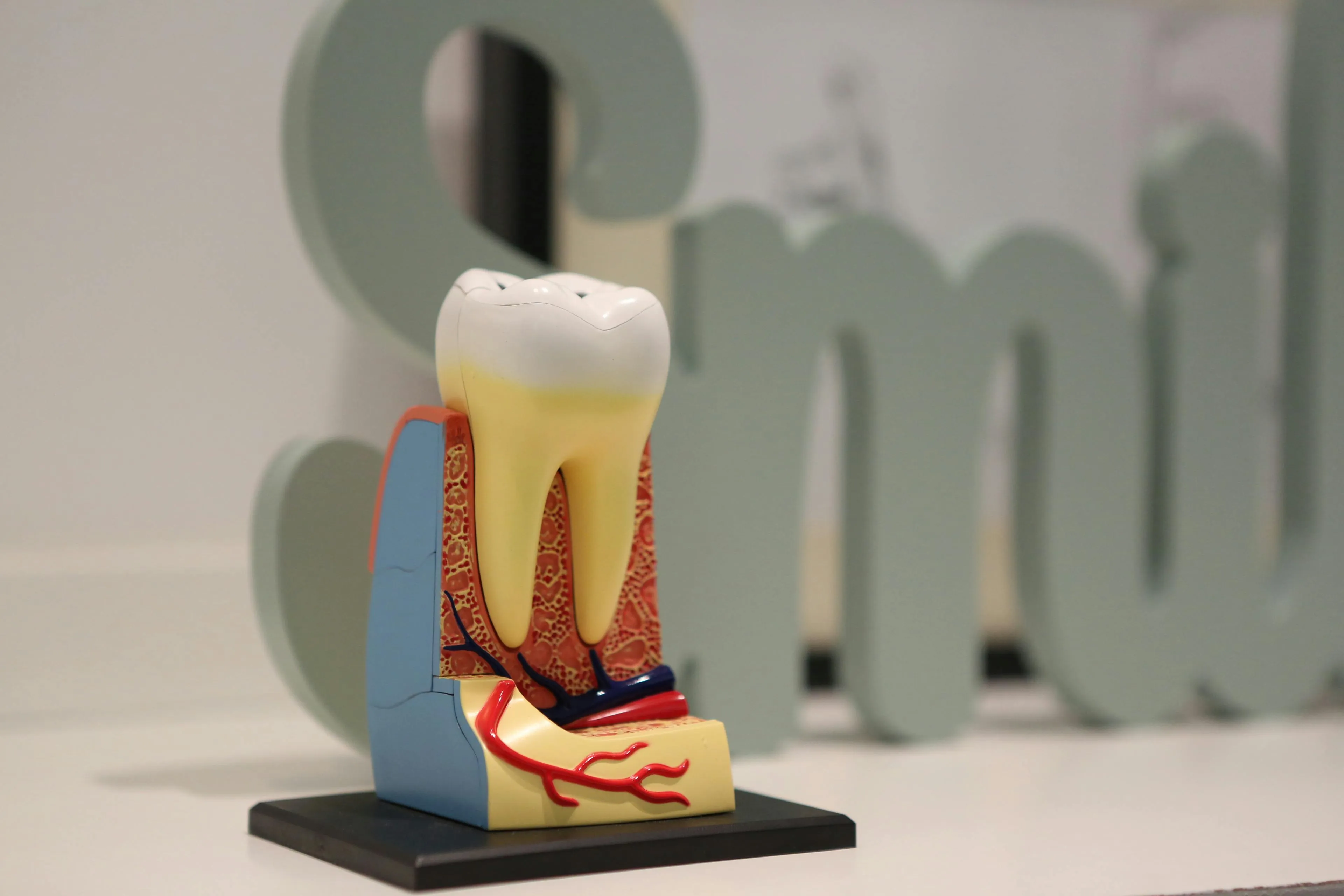 Dantis prieš endodontinį gydymą - Pavyzdys